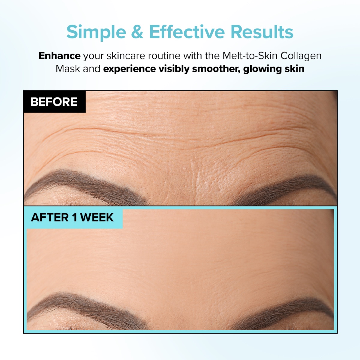 Forehead before and after 1 week